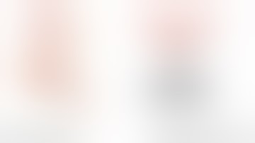 Bypass - Side to side for a mycotic M3 aneurysm