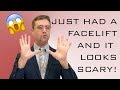 10 Most Common Concerns After a Facelift | I Just Had a Facelift and It Looks Scary! |