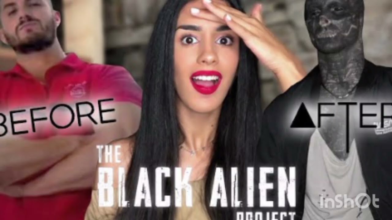 من شاب وسيم إلى وحش مخيف 👽 Anthony Loffr