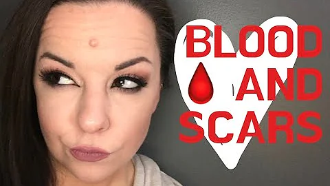 STORYTIME | Blood and Scars