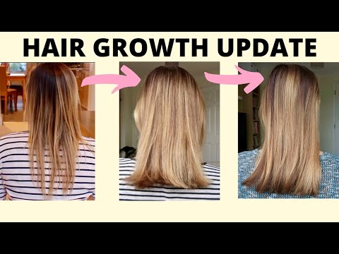 Can Birth Control Cause Hair Loss? | Guide to Growing Out Your Hair | Hair Growth Tips
