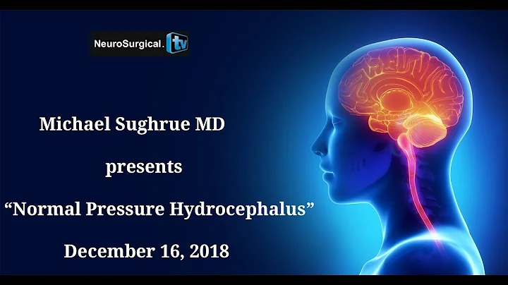 Michael Sughrue MD Presents "Normal Pressure Hydro...