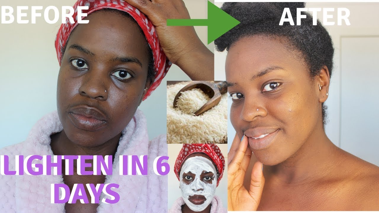 How I How i BRIGHTENED MY SKIN IN 6 DAYS| REALISTIC and Natural way to  reduce hyperpigmentation - YouTube