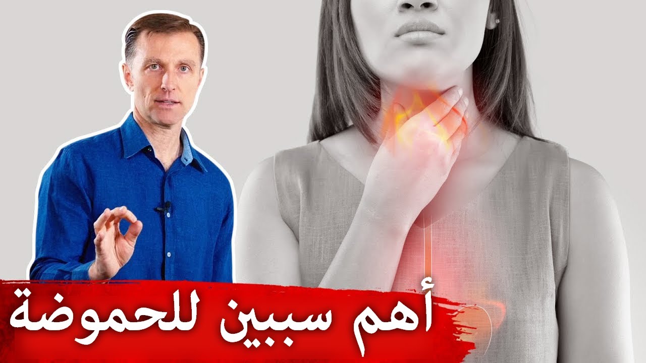 ارتجاع المريء وحمض المعدة | الشعور بالحرقة أو الحموضة