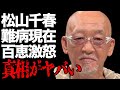 松山千春の“難病”で“激痩せ”した現在の姿に言葉を失う...「恋」でも有名な歌手が中島みゆきと結婚をしなかった理由に驚きを隠せない...