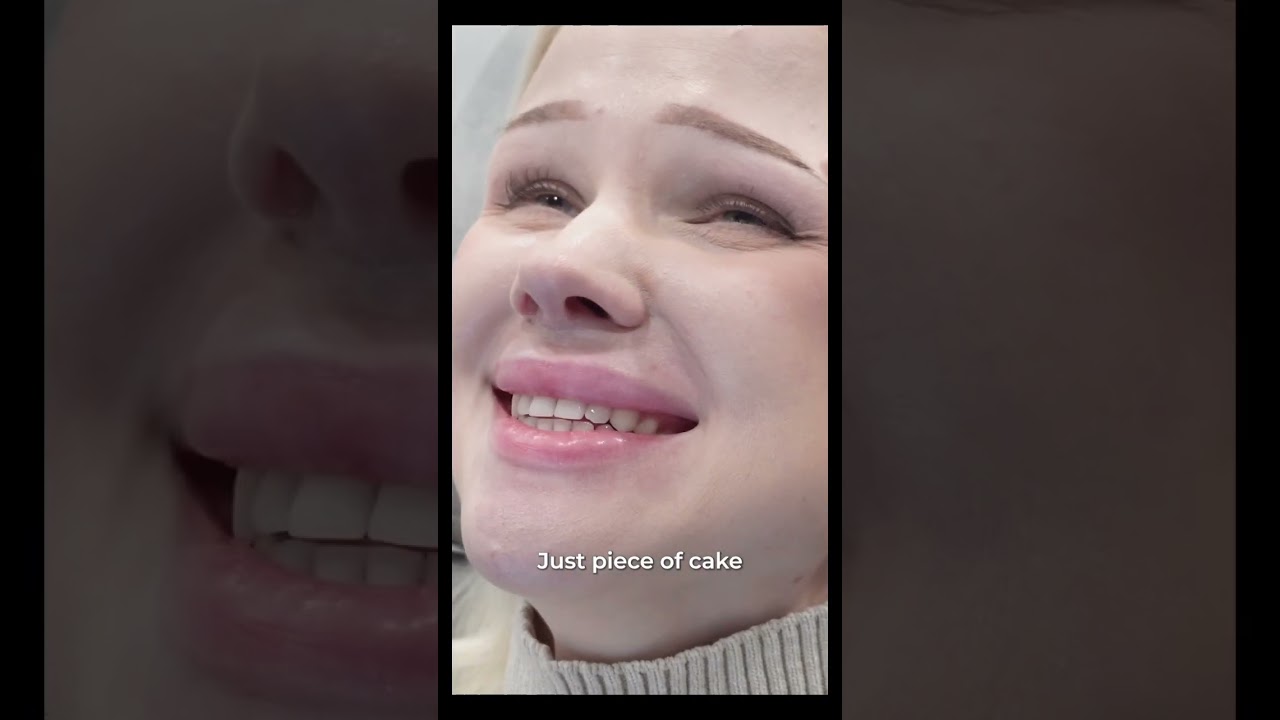 [Бьюти Блоссом Эмнэлэг] Уруулын хүссэн дүр төрхөд хүрсэн !! Ямар гайхалтай өөрчлөлт вэ! #лифтинг_үр_нөлөө #Хапжон_арьсны_эмнэлэг #уруул_дүүргэгч #гоо_сайхан #бьюти_блоссом_клиник #fyp