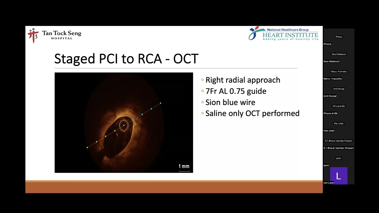 Calcium “Sniping” with OCT | DCB Academy Lesson