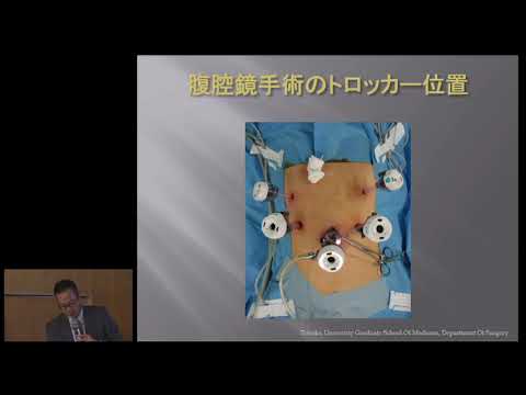 胃がんの手術について：武者 宏昭【もっと知ってほしい胃がんのこと in 仙台 】