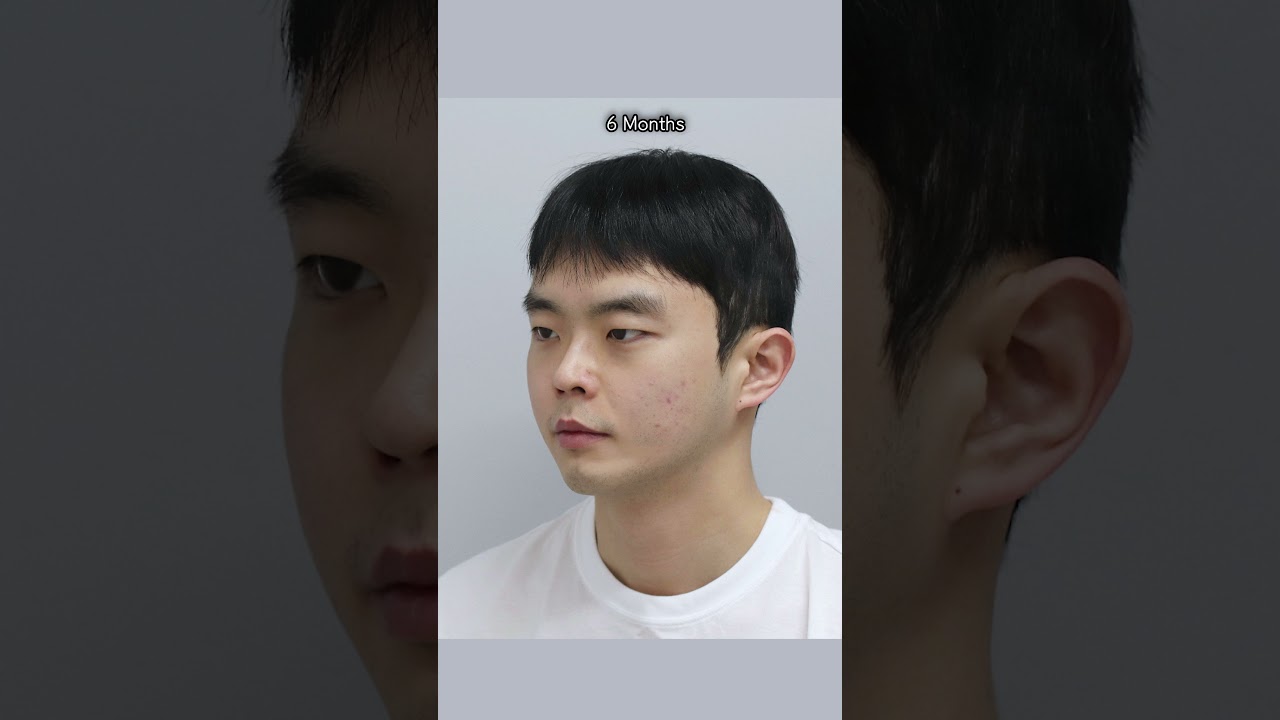 등록한썸네일