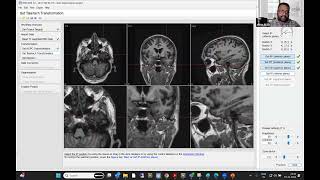Segmentation of human head MRI data with BESA MRI