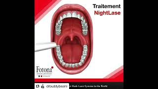 Nightlase Stop Snoring Laser Sydney CBD, Wahroonga & Canberra by MD Cosmedical Solutions Clinics