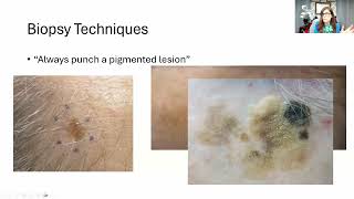 Down to Earth Dermpath: Dermalorian Webinar