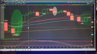 The easiest 5min 0dte scalping strategy you'll find on TOS