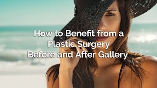 How to Benefit from a Plastic Surgery Before and After Gallery