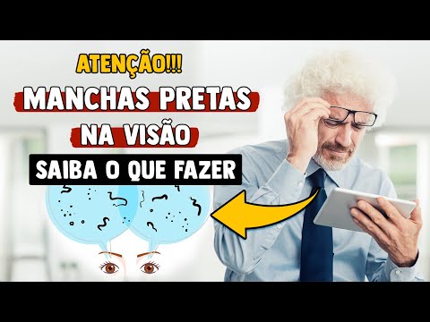 Vídeo: Como se livrar dos olhos vidrados?