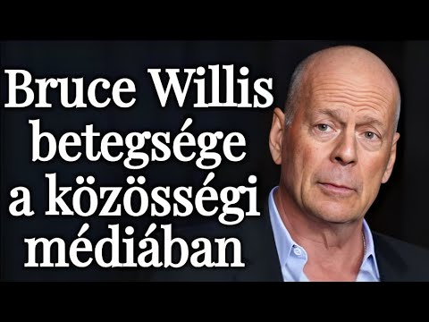 A leépülő istenember látványának ellenállhatatlan élménye, megküzdés az énidegen érzéseinkkel