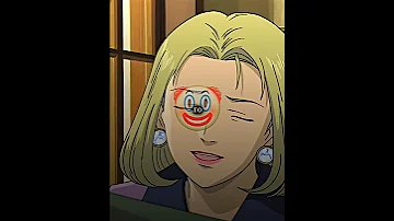 Doc Kenzo Tenma Edit BYE BYE Sleepwalker X Icewhore Anime Edit Monster Johan 