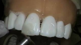 Class IV #8 DIFL
