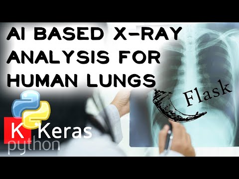 Deployed Keras model with Flask. AI Based X-Ray Analysis For Human Lungs (DEMO)