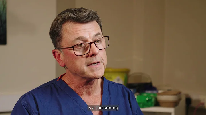 YAG Laser Capsulotomy Explained | Eye Treatment at The Forbury Clinic