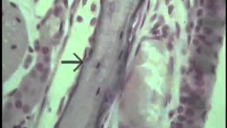 Histology of Cartilage and Bone