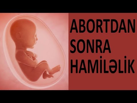 Video: Menstruasiya Sonrası Hansı Gündə Konsepsiya Mümkündür?