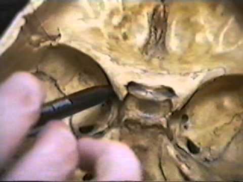 Video: Craniu - Structură, Funcție, Leziune