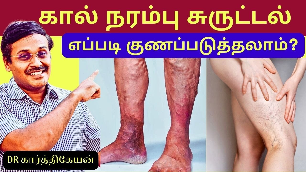 Narambu In English நரம்பு சுருள் நோய் குணமாக | varicose veins treatment exercise | Home ...