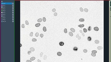 Nuclear segmentation 1