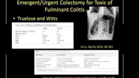 Criteria for considering 1, 2 or 3-stage procedure