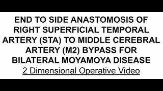 Download Lagu Bypass for Moyamoya Disease MP3