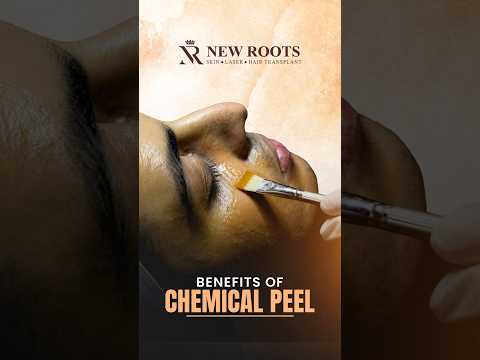Top Benefits of Chemical Peel for Healthy Skin #skin #viral #shorts
