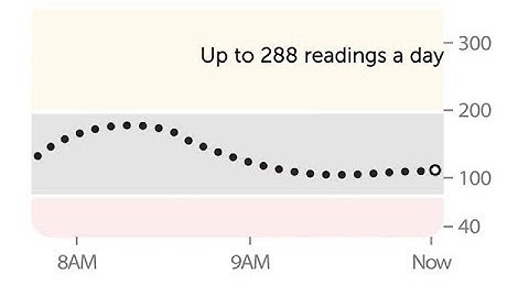 How the Dexcom CGM Works