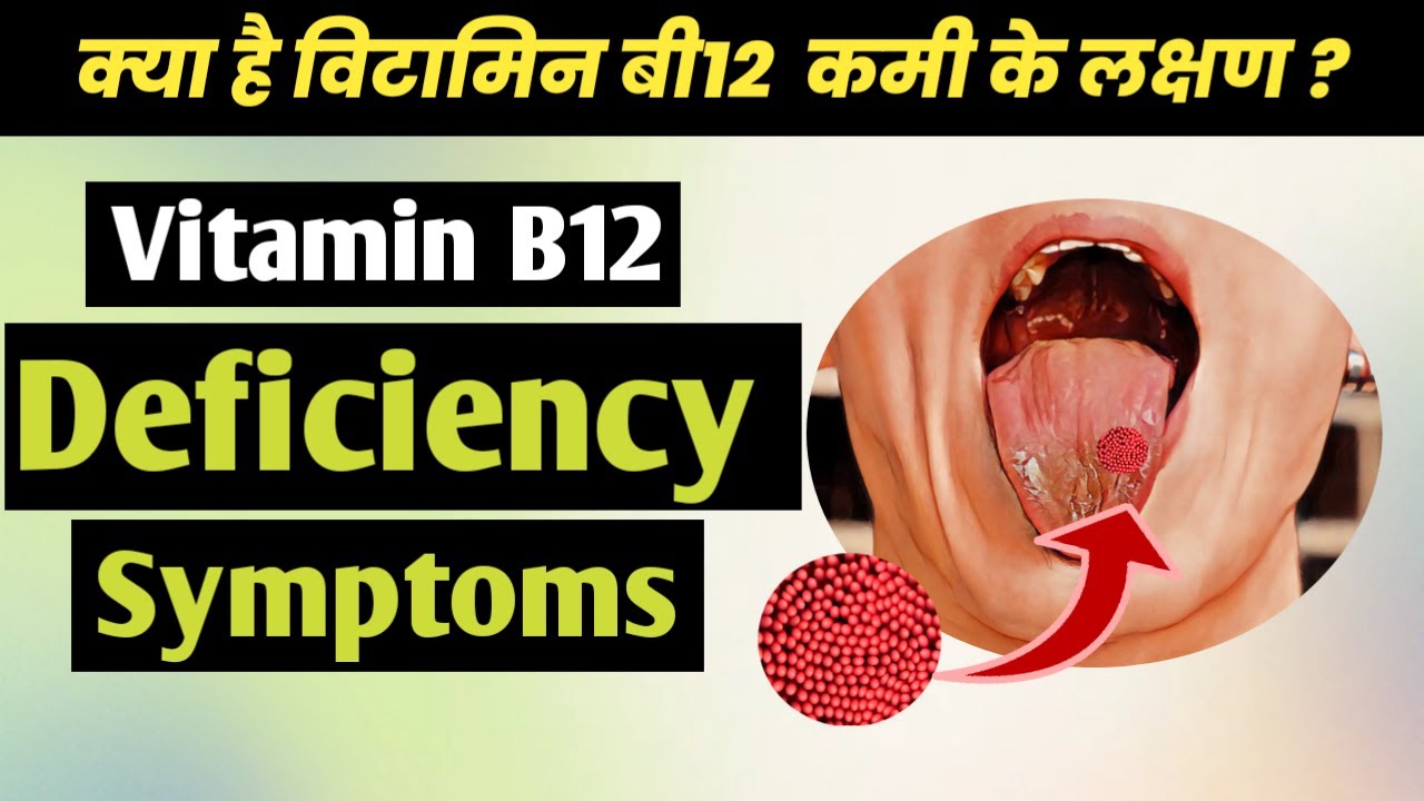 Vitamin B12 what happens when your vitamin B12 is low😱विटामिन बी12