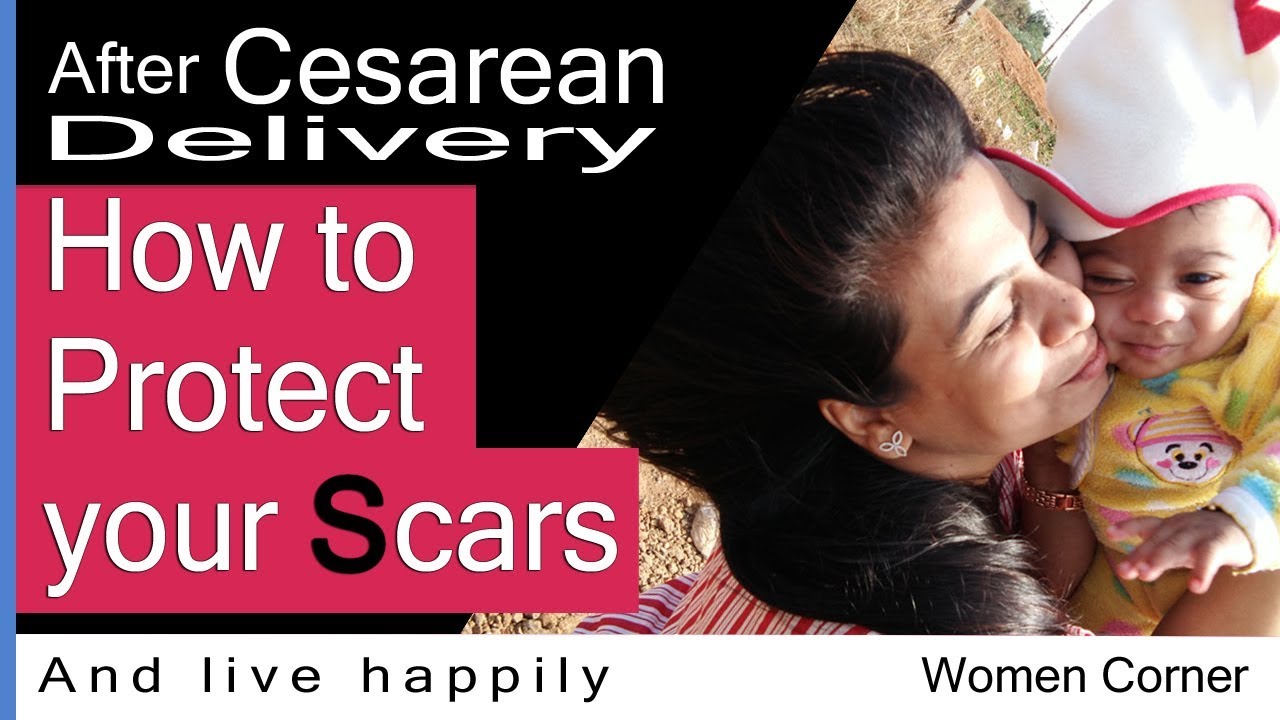 AFTER CESAREAN / C-SECTION RECOVERY TIPS & CARE HOW TO PROTECT YOUR