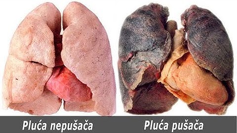 Pušite duže od 5 godina - Ovaj napitak će vam očistiti pluća.