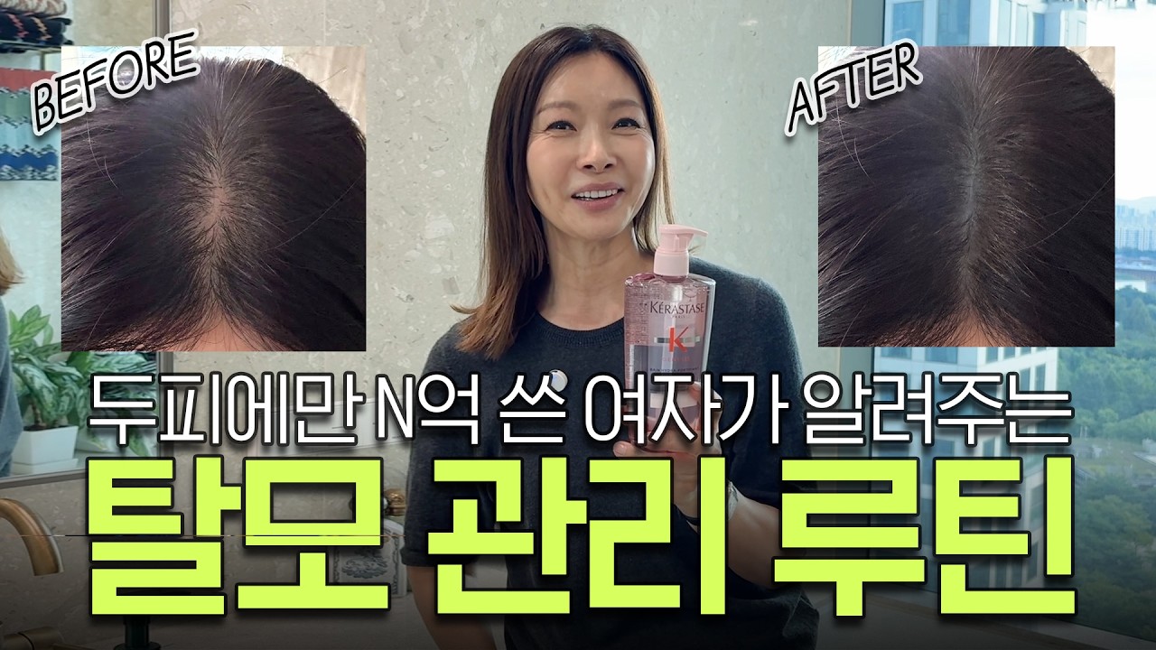머리 감을 때마다 한 움큼? 머리숱 줄었다면 지금 당장 하세요! 데일리 탈모 관리 루틴 공개❗ 탈모 제품 추천|지완Gwan's pick
