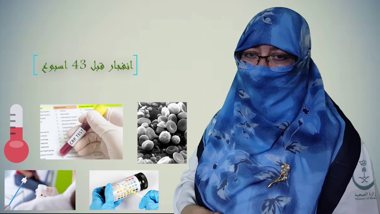 كيف نتعامل مع (انفجار كيس مياه الجنين المبكر) ؟! .