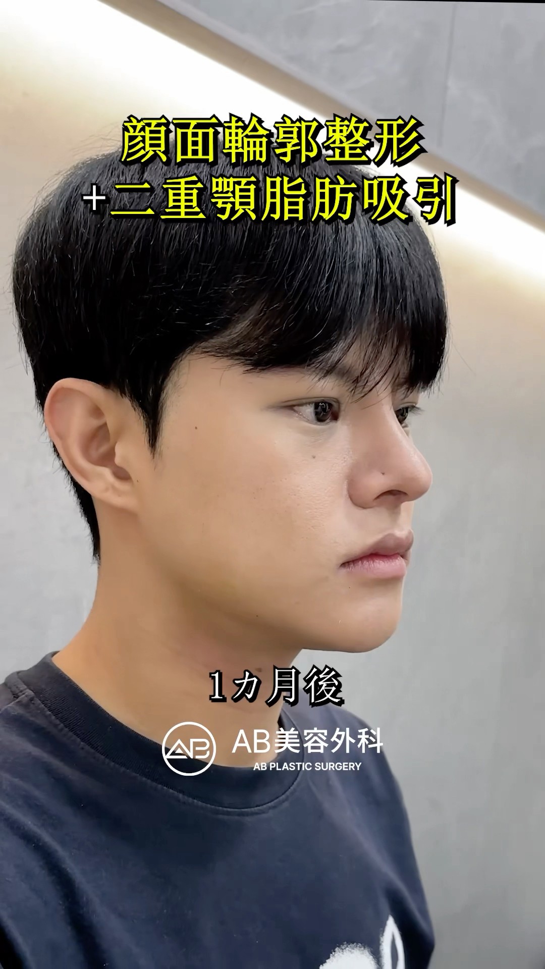 顔小さすぎ！韓国整形の奇跡 #shorts