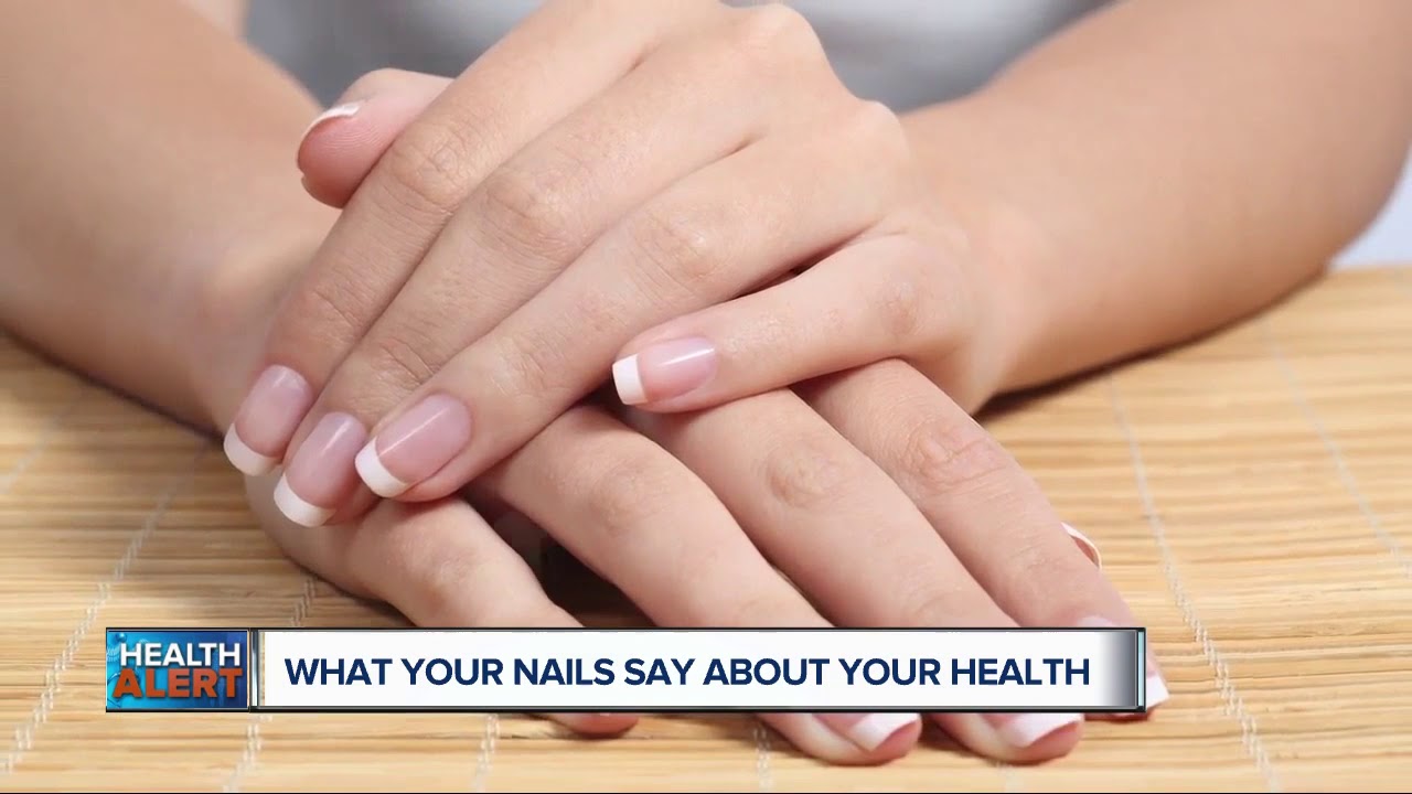 What Your Fingernail Tell About Your Health | Lyfboat