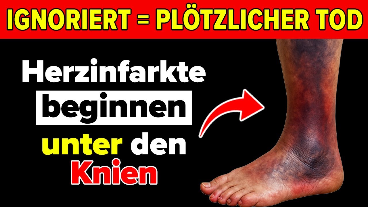Herzinfarkt-Warnzeichen in den Beinen – Tausende Senioren übersehen sie täglich!