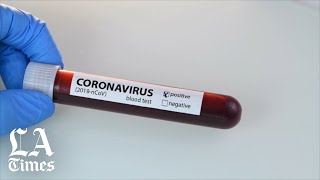 ‘Broken’ coronavirus tracking system leaves California in the dark: ‘We have no idea’