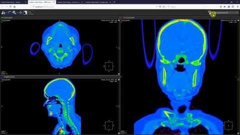 Inobitec DICOM Viewer Web Interface