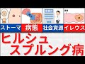 【8分で解説、12分で国試問題】ヒルシュスプルング病について解説