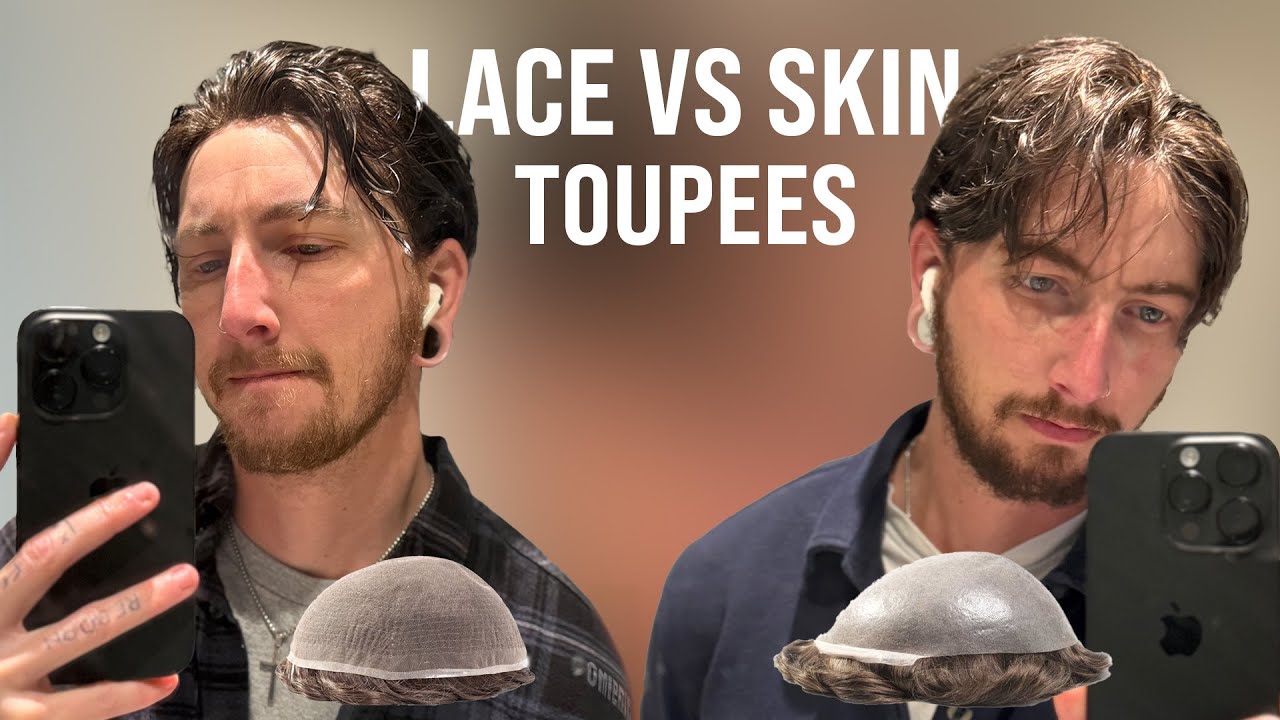 French Lace vs Thin Skin Hair System!