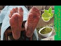 استخدامات الحناء في علاج الآم الظهر وحرارة القدمUses Of Henna In The Treatment Of Back And The Foot 