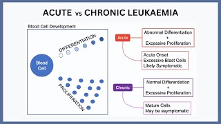 Acute vs Chronic Leukaemia Explained