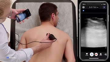 Ultrasound Education: Performing an Erector Spinae Plane Block