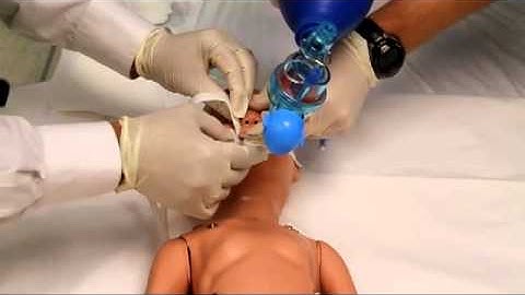 Preventing Unplanned Extubations