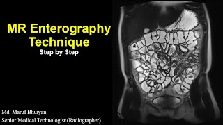 MR Enterography Technique Step by Step | Protocols | Planning | MR Enterogram Procedure |Preparation MR Enterography Technique Step by Step | Protocols | Planning | MR Enterogram Procedure |Preparation